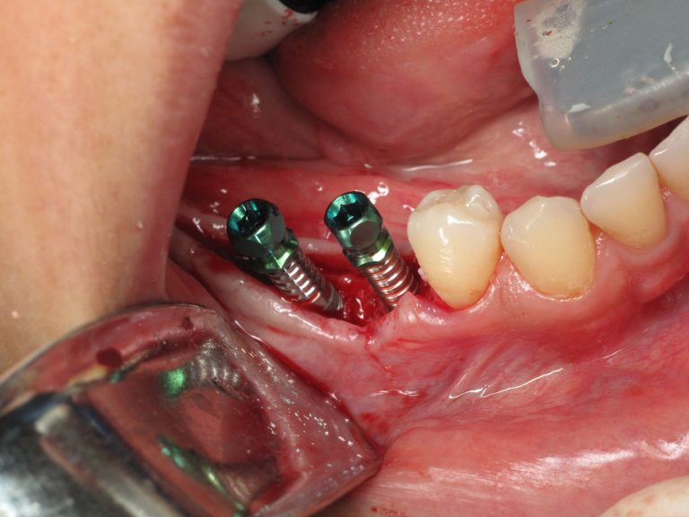 5 Effective Ways to Transform the Look of Your Smile