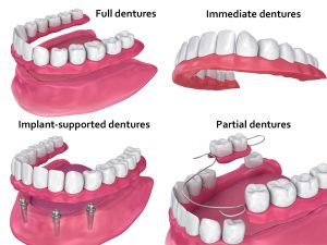 different types of dentures